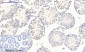 mTOR (phospho Ser2448) Polyclonal Antibody